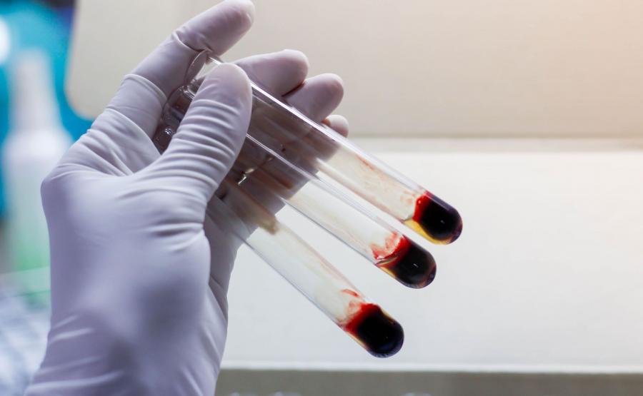 5. Anemia