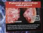 Z okazji Światowego Dnia Bez Tytoniu ministerstwo zdrowia zorganizowało wystawę grafik, jakie w różnych krajach straszą z paczek papierosów