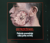 Z okazji Światowego Dnia Bez Tytoniu ministerstwo zdrowia zorganizowało wystawę grafik, jakie w różnych krajach straszą z paczek papierosów